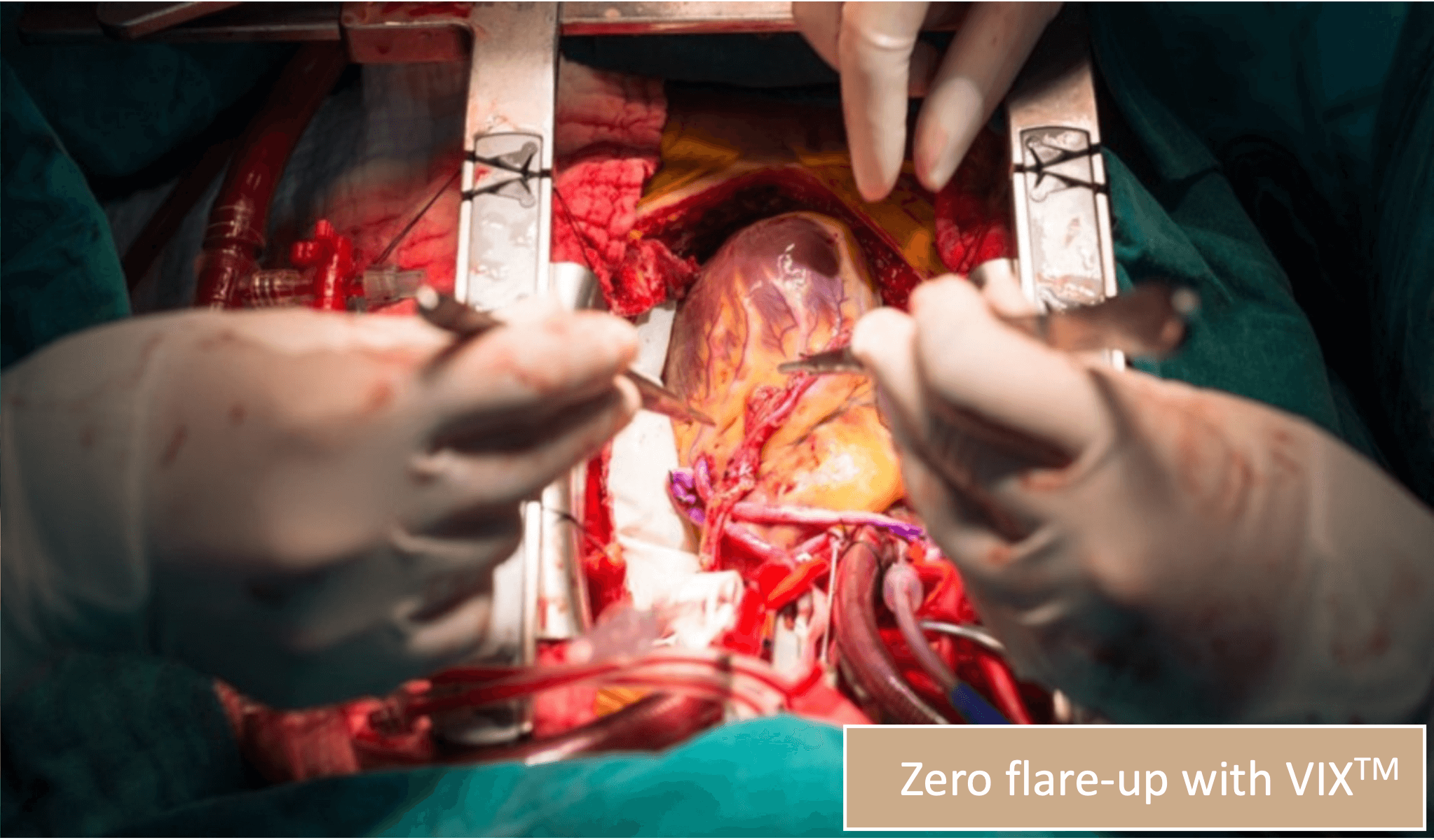 Intelligent Surgical Camera VIX