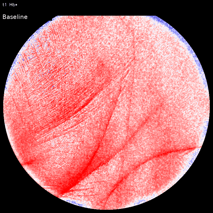 Animated multispectral visualization of absolute hemoglobin response during a cuff challenge