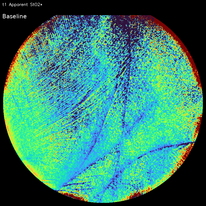 Animated multispectral visualization of apparent tissue oxygen saturation over time